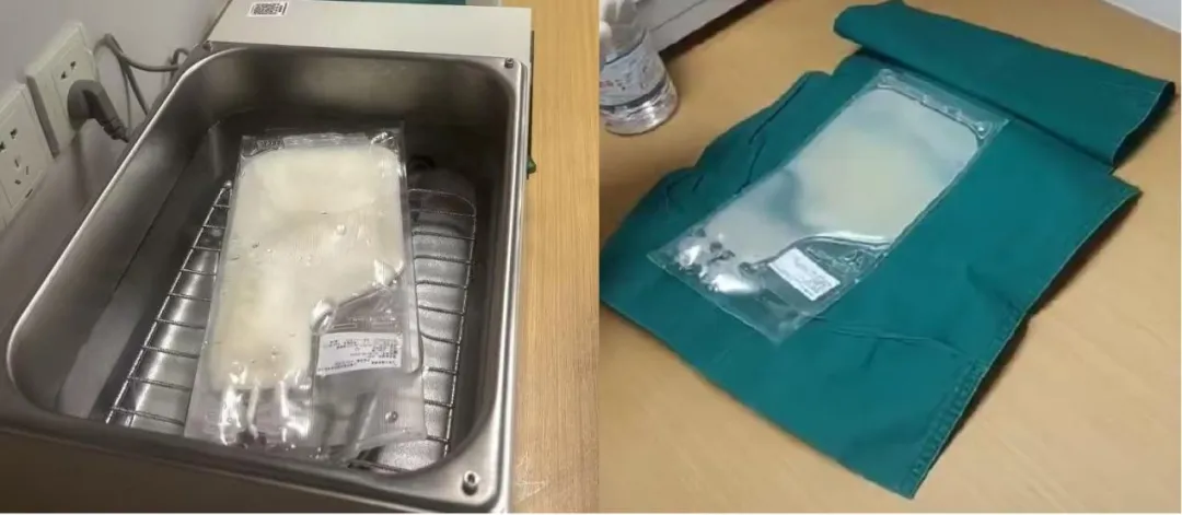 TILs cell therapy infusion bag and sterile preparation for clinical administration