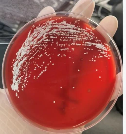 Blood agar plate after 48 hours showing white, dry, downy aerial colonies of Nocardia otitidiscaviarum