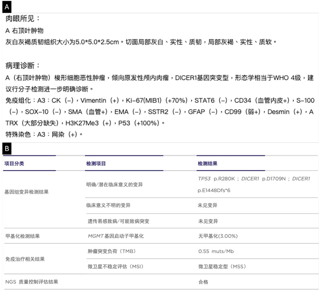 Stereotactic biopsy pathology report showing spindle cell malignant tumor with inconclusive diagnosis favoring mesenchymal origin