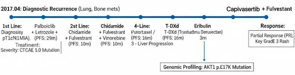 Treatment timeline from 2017 to 2026 showing six lines of therapy for HR+/HER2- advanced breast cancer: CDK4/6 inhibitor, HDAC inhibitor, chemotherapy, ADC, and finally AKT inhibitor with genomic profiling revealing AKT1 p.E17K mutation